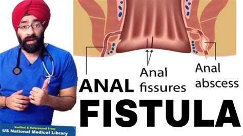 anal fissure meaning in tamil